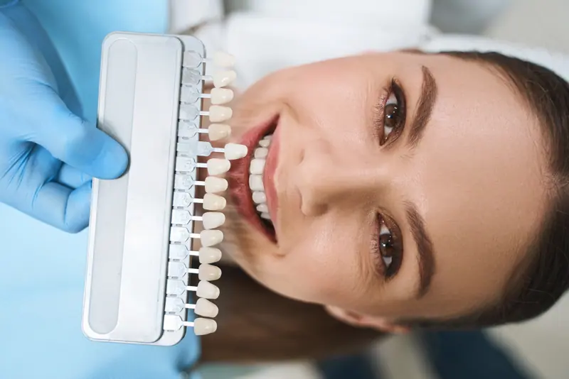 Woman smiling with tooth color chart in clinic